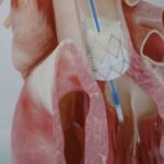 İnönü Üniversitesi’nden Prof. Dr. Pekdemir, genç ölümlerin çoğunun genetik nedenlerden kaynaklandığını belirtti.