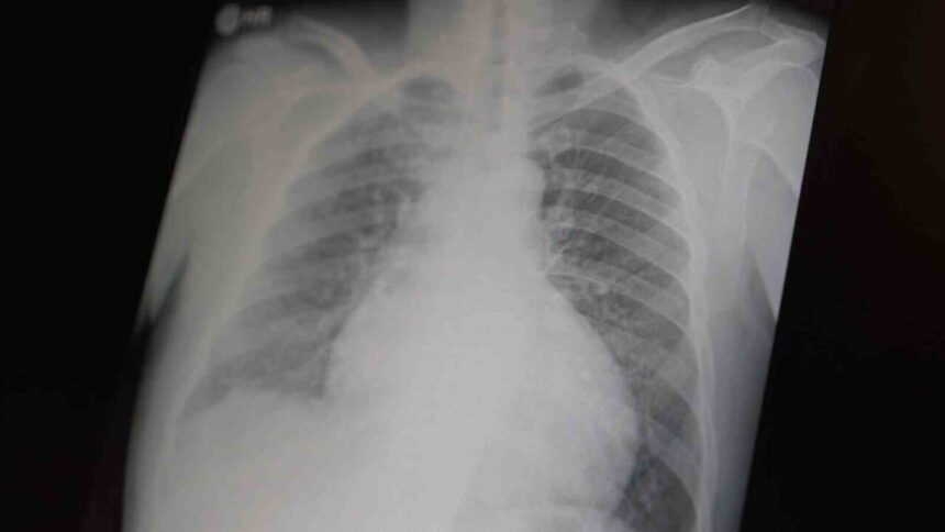 Prof. Dr. Şevket Özkaya: Metamfetamin ve kokain gençler için büyük tehlike oluşturuyor.